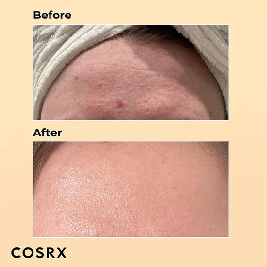 تصویر  اسنس حلزون کوزارکس COSRX اصل مدل Advanced Snail آبرسان و ترمیم کننده 100ml