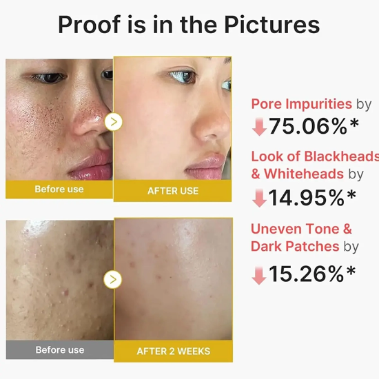 تصویر  سرم پیل شات زردچوبه و کوجیک اسید مدی کیوب Medicube لایه بردار 80ml