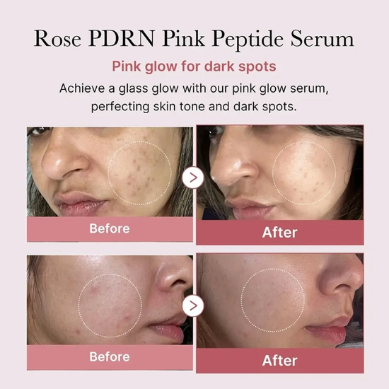تصویر  سرم صورت پپتاید جوانساز مدی کیوب medicube اصل مدل Pink حجم 30ML